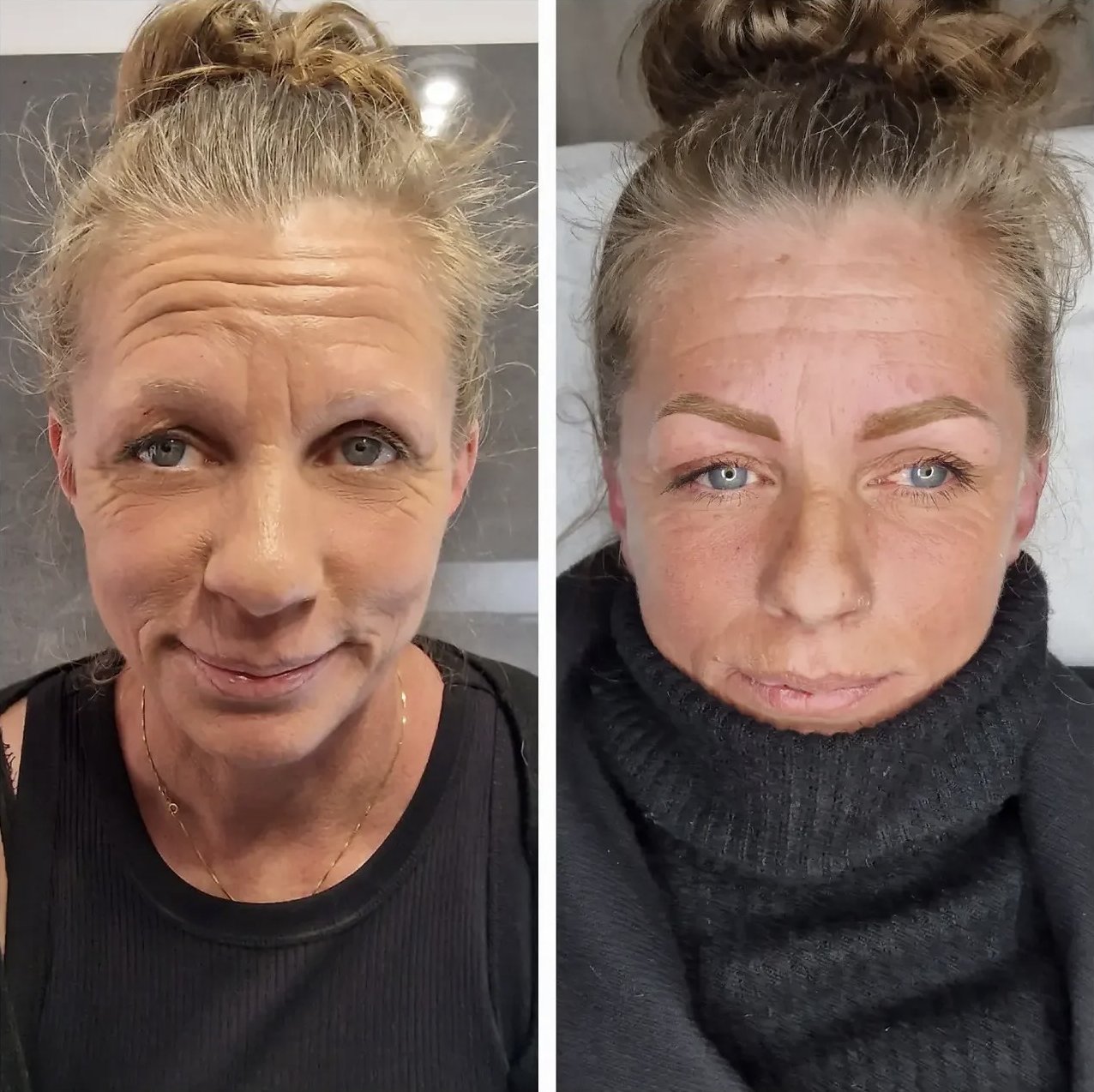Prima e dopo sopracciglia
